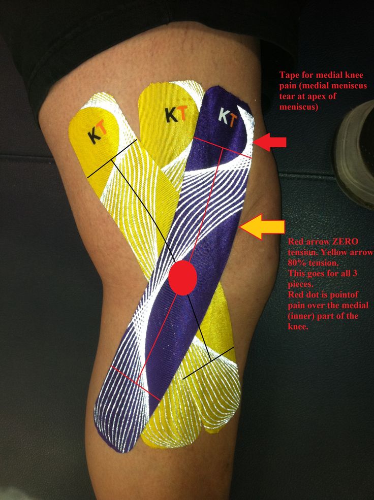 knee pain location chart