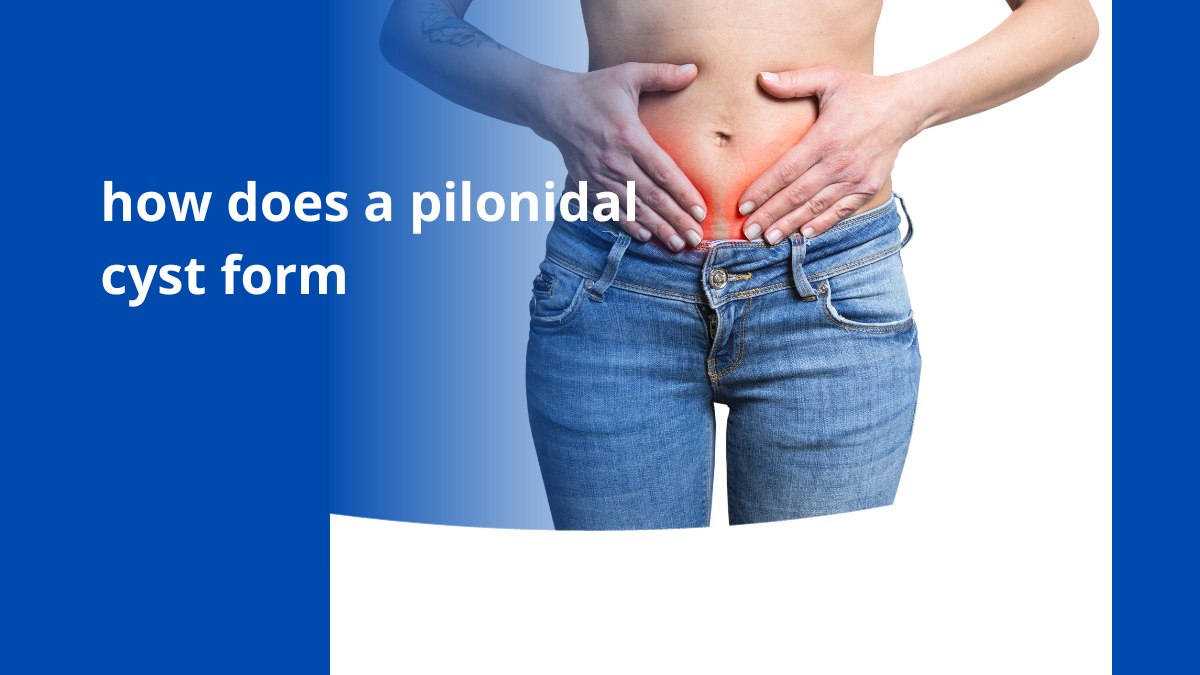 how does a pilonidal cyst form